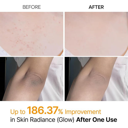 Dr. Melaxin Peel Shot Kojic Turmeric Spray 200ml