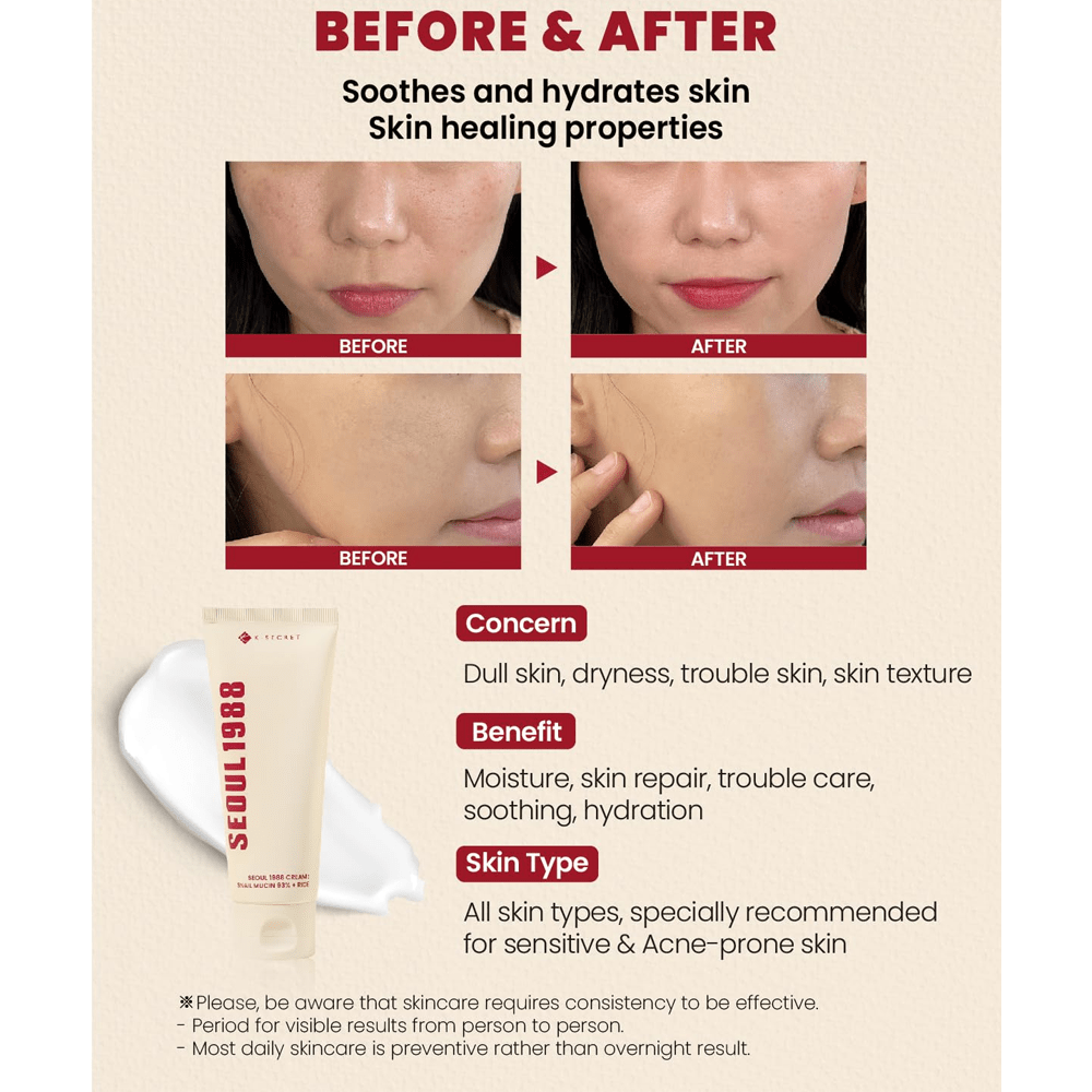 K Secret Seoul 1988 Cream Snail Mucin 93% + Rice - 100 ml