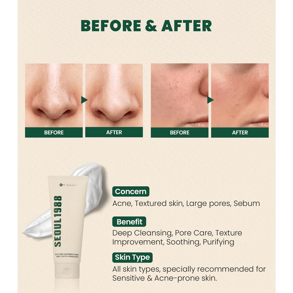 K Secret Seoul 1988 Cleansing Foam Pine Cica 1% + Probiotics - 150 ml