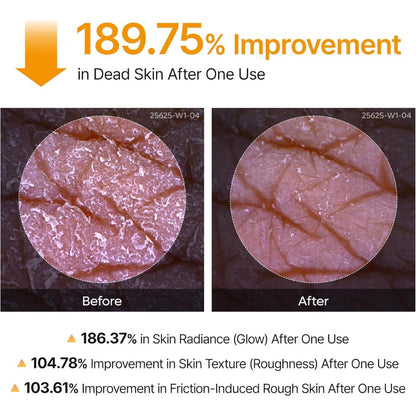 Dr. Melaxin Peel Shot Kojic Turmeric Spray 200ml